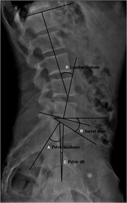 Evaluation of additional causes of hip pain in patients with femoroacetabular impingement syndrome